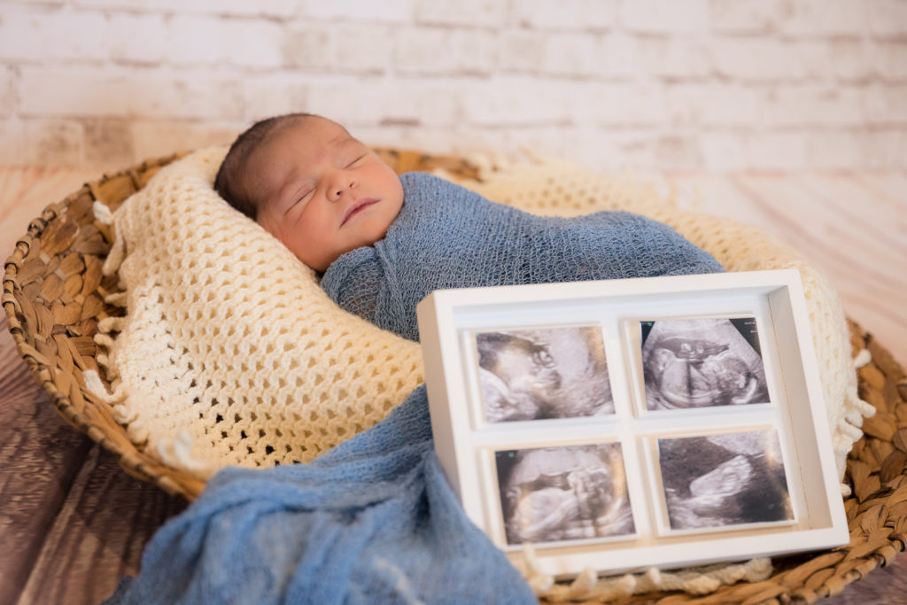 newborn with ultrasound photo